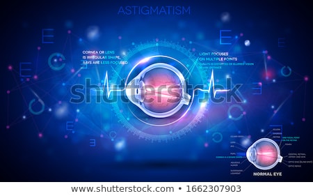 Stock photo: Diagnosis - Astigmatism Medicine Concept 3d Illustration