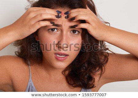 Zdjęcia stock: A Young Girl Having Acne