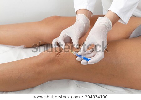 Сток-фото: Botox Leg