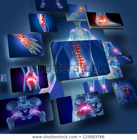 Foto stock: Arthritis Diagnosis Medical Concept