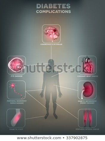 Foto d'archivio: Diabetes Mellitus Affected Organs