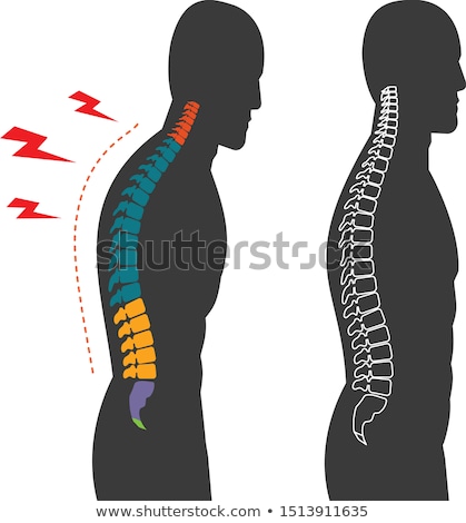 Foto stock: Human Spine Pain