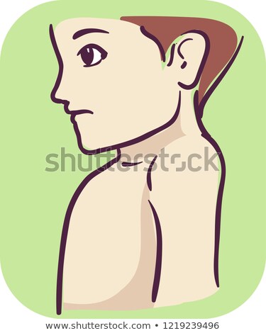 Foto stock: Kid Boy Symptom Short Neck Illustration