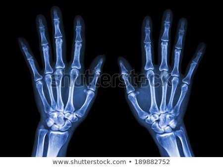 [[stock_photo]]: Doctor Examining X Ray Of Hand