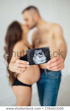 Сток-фото: A Happy Married Couple Is Holding In Their Hands A Snapshot Of An Ultrasonic Study Of The Baby