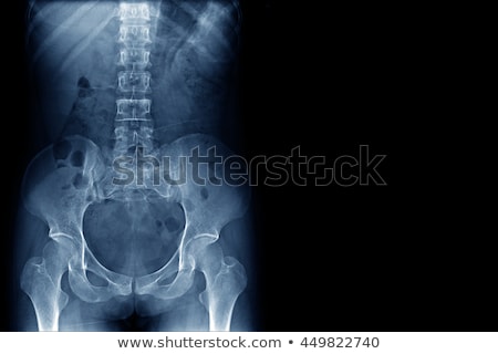 Stock photo: Doctor Examining X Ray Of The Human Spine