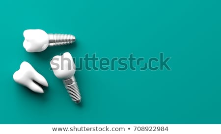 Stockfoto: Tooth Implant