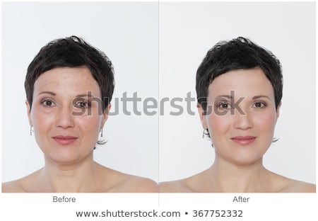 Foto stock: Senior Womans Eye With And Without Wrinkles