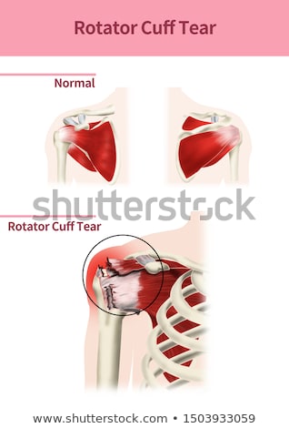 [[stock_photo]]: Cuffs