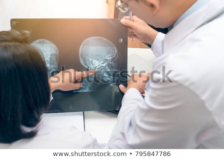 Foto stock: Head With Office Operation Concept