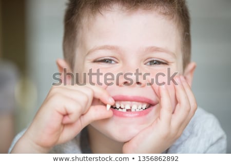Stock photo: Little Boy Showing His Milk Tooth In His Hand