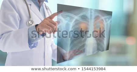 Stok fotoğraf: Diagnosis - Asthma Medical Concept