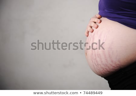 Foto stock: Pregnant Woman With Very Natural Stomach - Cracks On Skin