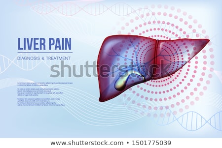 Foto stock: Cirrhosis - Printed Diagnosis Medical Concept