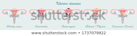 Foto stock: Anatomy Female Reproductive System