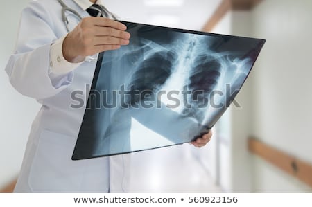 Stok fotoğraf: X Ray