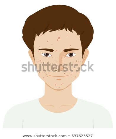 Stock photo: Man With Sking Problem