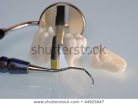 Foto stock: Iente · del · juicio · humano · real · e · implante · dental