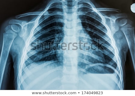 Stok fotoğraf: Examining Chest X Ray