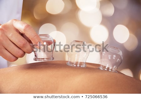 Foto stock: Cupping Therapy