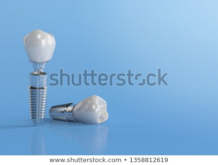 Stockfoto: Enselijke · tand · en · titaniumimplantaat