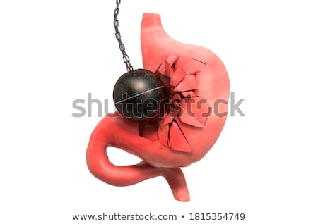 Stockfoto: Trauma - Medical Concept 3d Render