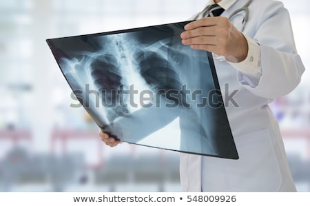 ストックフォト: Doctor Examining An Lungs X Ray