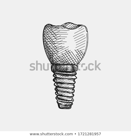 Stock fotó: Dentist Stomatology Tooth Implant Vector Icon