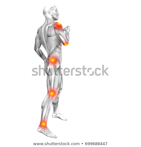Stockfoto: Hand Symptom Joint Redness Illustration