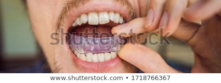 Stock photo: Man Placing A Bite Plate In His Mouth To Protect His Teeth At Night From Grinding Caused By Bruxism