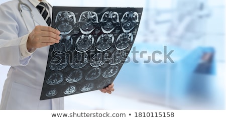 Stock photo: Mri Scan At Hospital