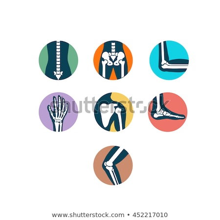 Foto stock: Human Legs And Knee Joint Detailed Anatomy Painful Joint