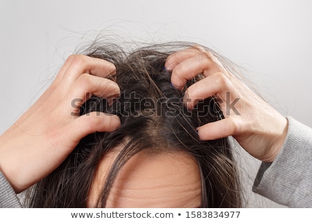 ストックフォト: Woman Scratching Her Itchy Head