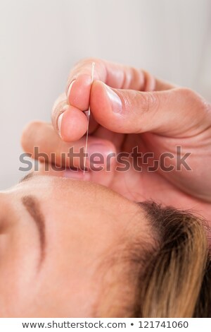Zdjęcia stock: Close Up Of Woman Undergoing Acupuncture Treatment On Her Belly