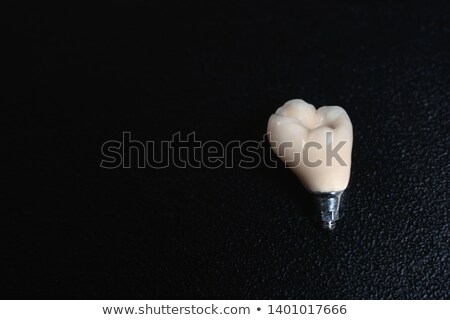 Foto stock: Set Of Different Dentures