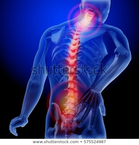 Сток-фото: 3d Painful Spine