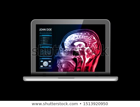 Stockfoto: Notebook Monitor With Medical Mri And Other Real Time Analyzes Medicine Of The Future Vector Illus