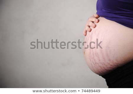 Terhes nő természetes gyomorral - repedések a bőrön Stock fotó © Zurijeta