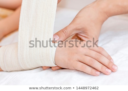Foto stock: Sprained Hand