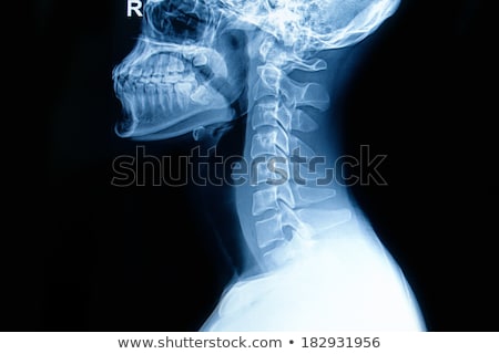 Zdjęcia stock: X Ray Image Of Neck