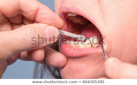 Stock foto: Dental Crown Procedure