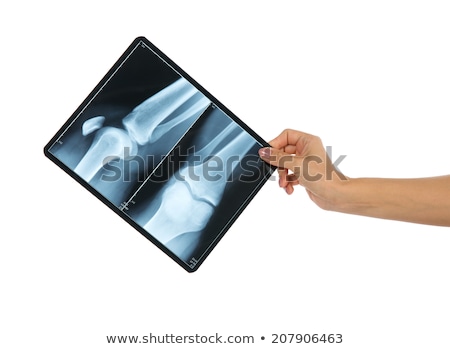 [[stock_photo]]: Doctor Examining An Elbow X Ray