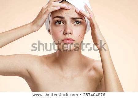 Zdjęcia stock: Acne Facial Care Teenager Woman Squeezing Pimple
