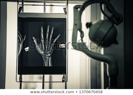 Сток-фото: Radiologist Checking An X Ray Image