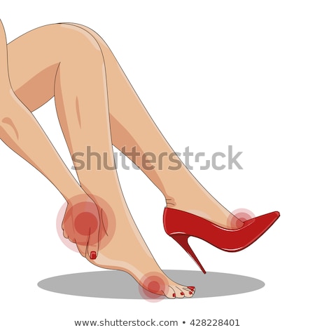 Stok fotoğraf: Female Legs In High Heel Shoes With Varicose Veins Vector Isolated Cartoon Illustration