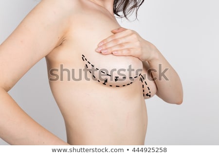 Сток-фото: Plastic Surgery Doctor Draw Line Patient Breast