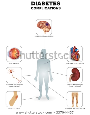 Zdjęcia stock: Diabetes Affected Organs