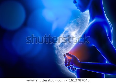 Zdjęcia stock: Breast Disease Diagnosis Medical Concept 3d Render