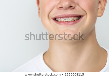 [[stock_photo]]: Young Man With Braces