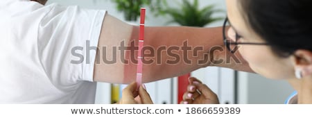 Foto stock: Diagnosis - Urticaria Medical Concept